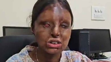 Tragedy into triumph: Chandigarh acid attack survivor scores 95.6 pc in CBSE Class 12