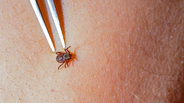 Lyme disease is becoming more common. But its symptoms aren’t always easy to spot Lyme disease is becoming more common. But its symptoms aren’t always easy to spot